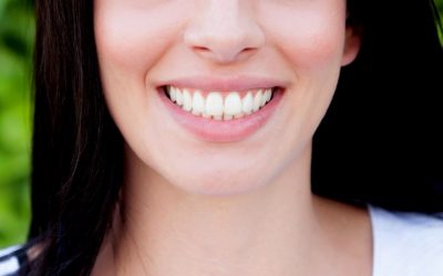 Implantes dentales, todo lo que debes saber