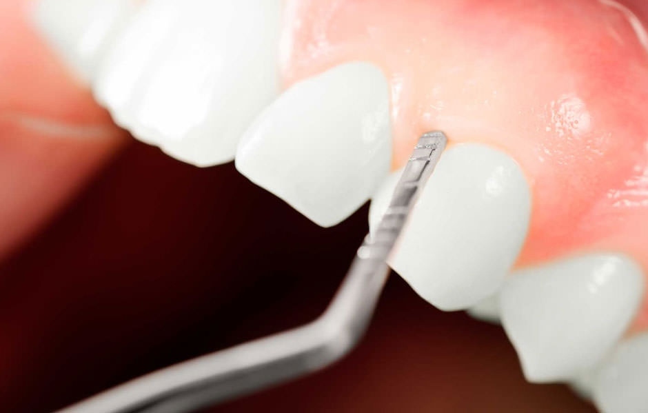 periodoncia tratamientos dentales clinicadentaldoriamedina