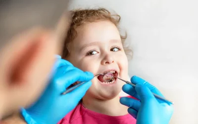 La Placa dental en la salud bucal infantil
