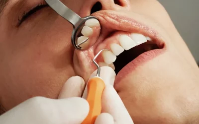 ¡Hablemos de la enfermedad periodontal!