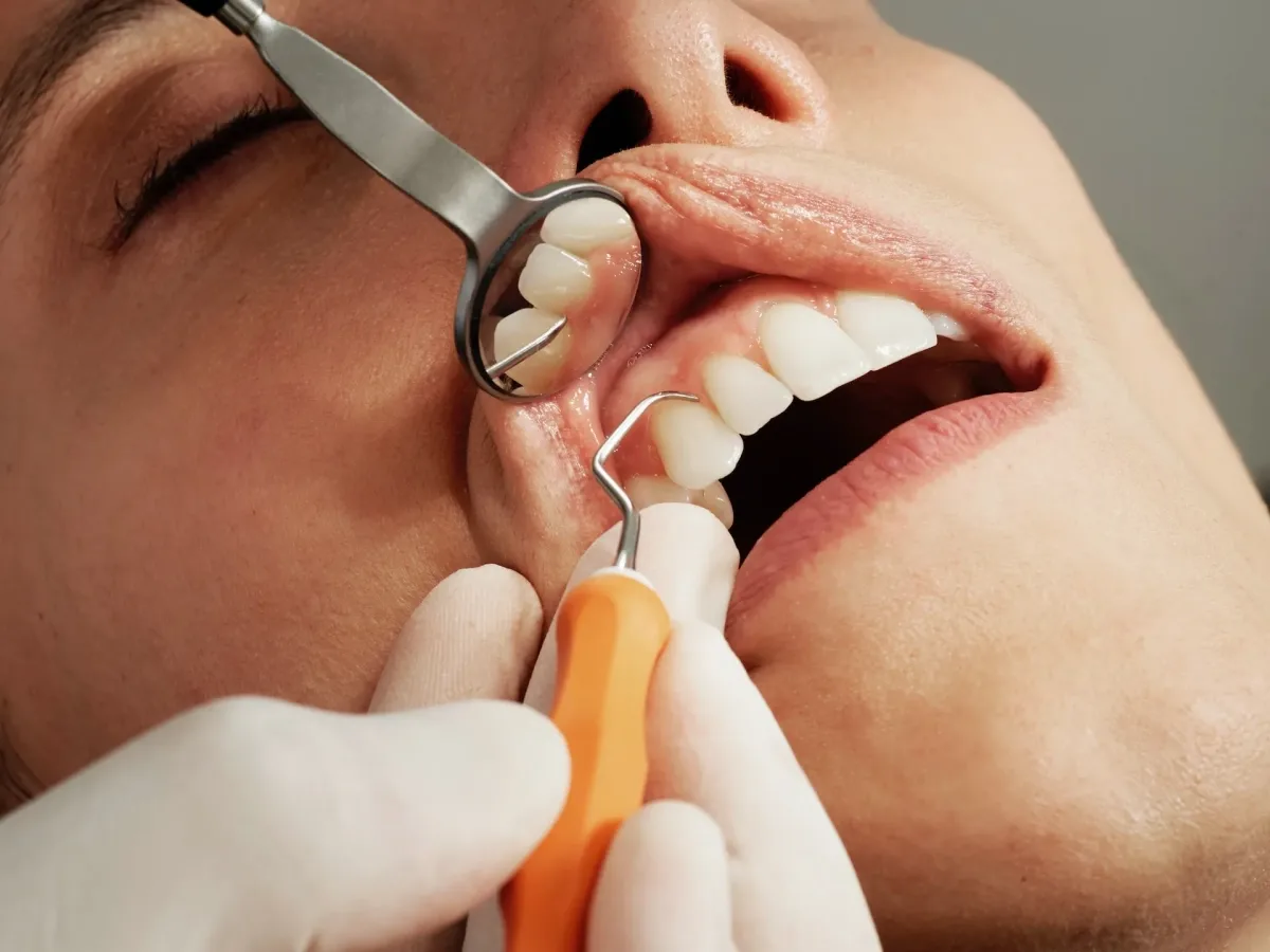 Tratamiento-periodontal
