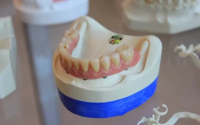 La restauración dental es importante