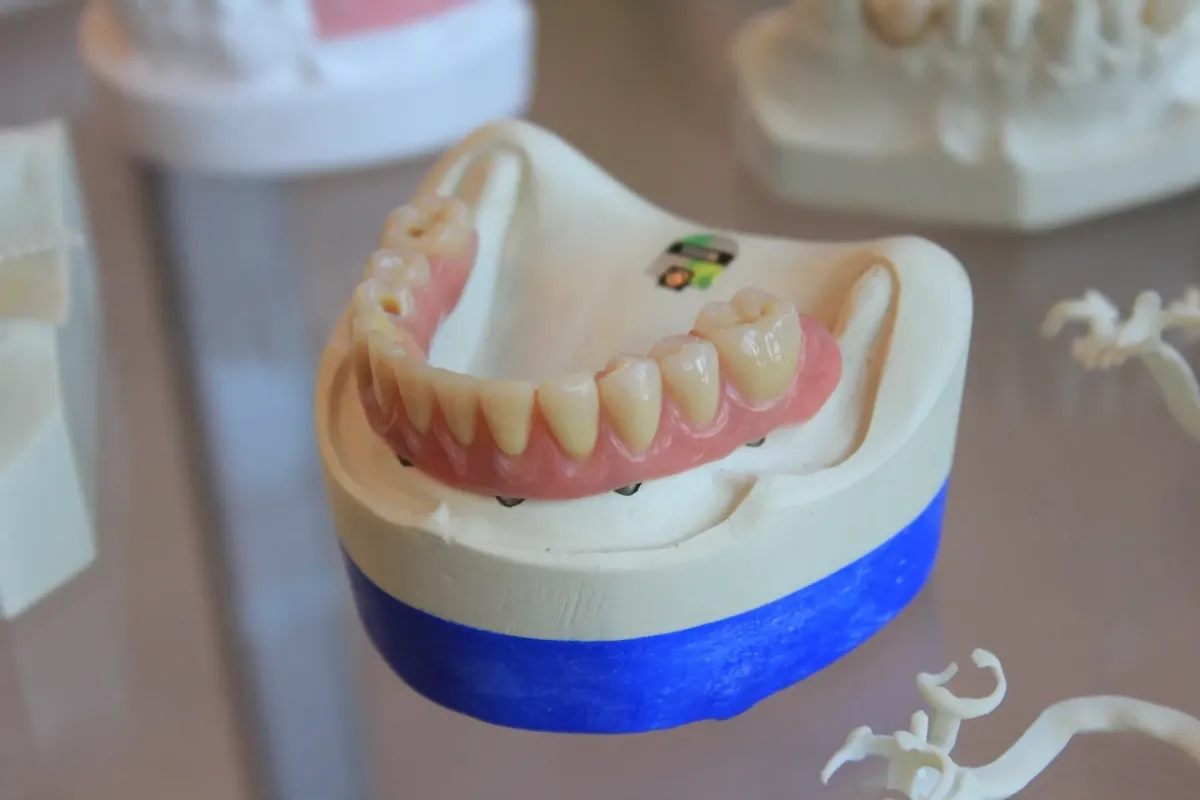 implantes dentales pieza