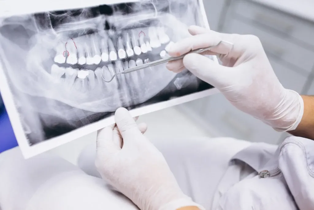 radiografia-dientes